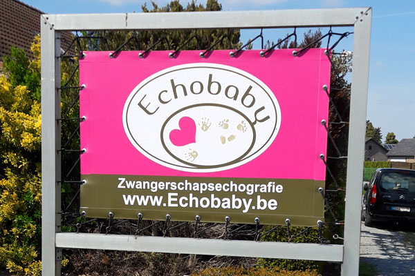  Echobaby